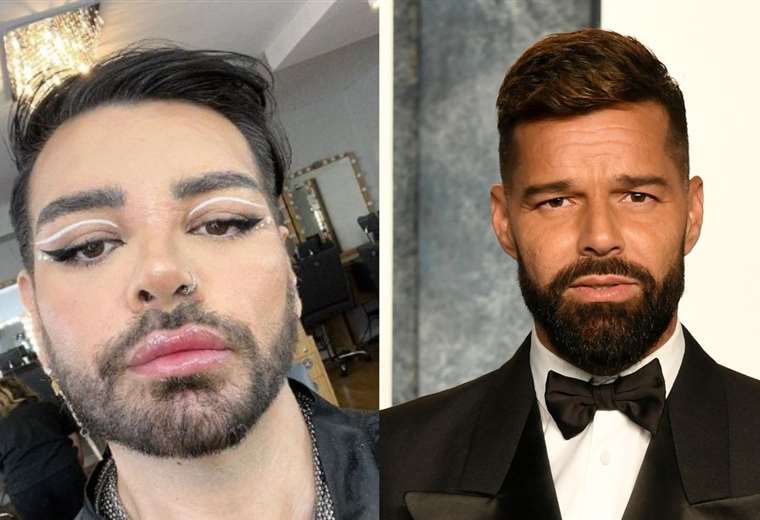 Hombre se somete a más de 30 cirugías para parecerse a Ricky Martin