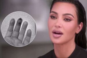 Kim Kardashian se fractura su mano tras golpearse con una puerta