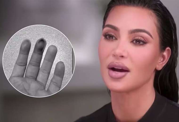 Kim Kardashian se fractura su mano tras golpearse con una puerta