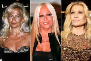 ¿Por qué todos hablan del rostro de Donatella Versace?